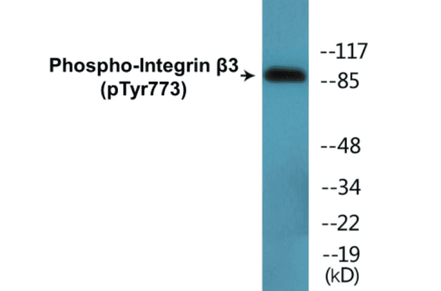 Western Blot - Integrin beta 3 (phospho Tyr773) Cell Based ELISA Kit (CBP1586) - Antibodies.com