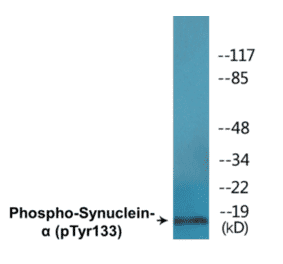 Western Blot - alpha Synuclein (phospho Tyr133) Cell Based ELISA Kit (CBP1691) - Antibodies.com