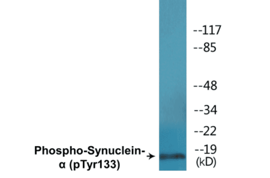 Western Blot - alpha Synuclein (phospho Tyr133) Cell Based ELISA Kit (CBP1691) - Antibodies.com
