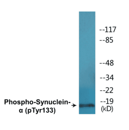 Western Blot - alpha Synuclein (phospho Tyr133) Cell Based ELISA Kit (CBP1691) - Antibodies.com