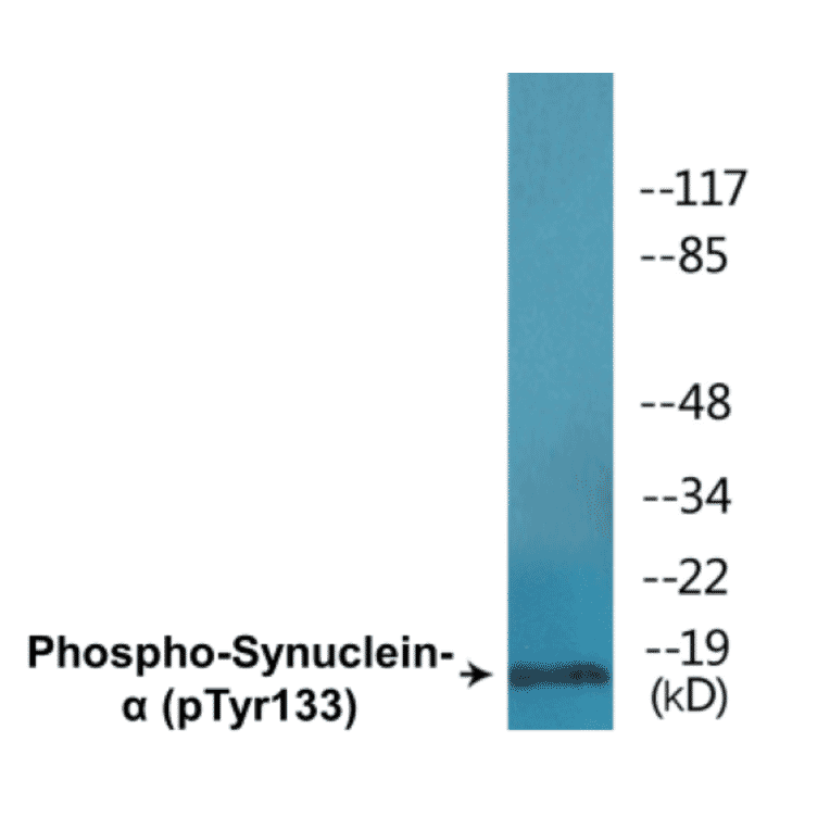 Western Blot - alpha Synuclein (phospho Tyr133) Cell Based ELISA Kit (CBP1691) - Antibodies.com