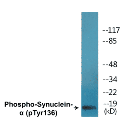 Western Blot - alpha Synuclein (phospho Tyr136) Cell Based ELISA Kit (CBP1692) - Antibodies.com