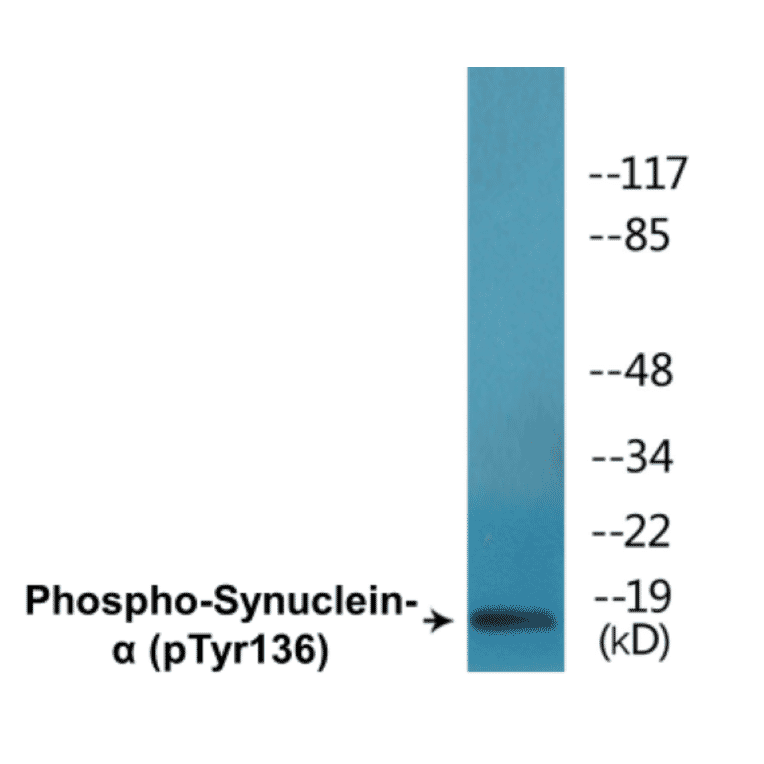 Western Blot - alpha Synuclein (phospho Tyr136) Cell Based ELISA Kit (CBP1692) - Antibodies.com