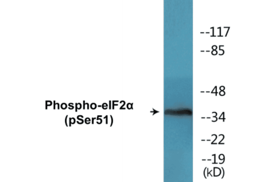 Western Blot - eIF2a (phospho Ser51) Cell Based ELISA Kit (CBP1538) - Antibodies.com