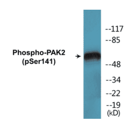 Western Blot - PAK2 (phospho Ser141) Cell Based ELISA Kit (CBP1763) - Antibodies.com