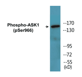 Western Blot - ASK1 (phospho Ser966) Cell Based ELISA Kit (CBP1494) - Antibodies.com