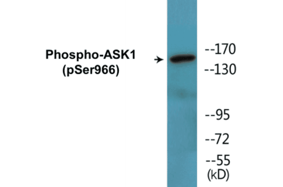 Western Blot - ASK1 (phospho Ser966) Cell Based ELISA Kit (CBP1494) - Antibodies.com