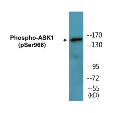 Western Blot - ASK1 (phospho Ser966) Cell Based ELISA Kit (CBP1494) - Antibodies.com