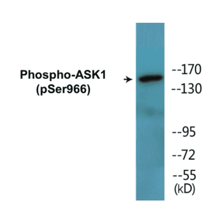 Western Blot - ASK1 (phospho Ser966) Cell Based ELISA Kit (CBP1494) - Antibodies.com