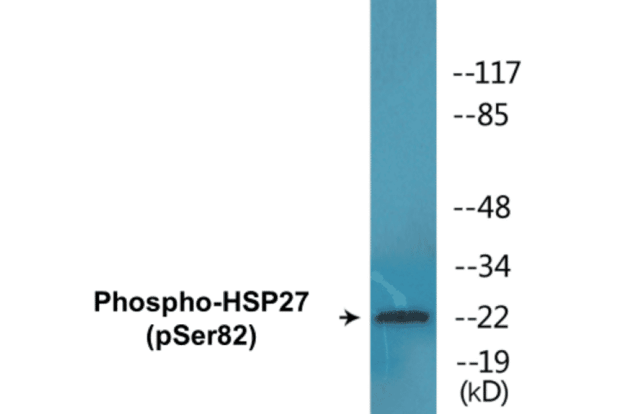 Western Blot - HSP27 (phospho Ser82) Cell Based ELISA Kit (CBP1581) - Antibodies.com