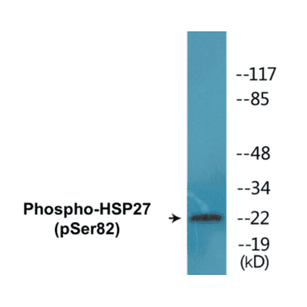 Western Blot - HSP27 (phospho Ser82) Cell Based ELISA Kit (CBP1581) - Antibodies.com