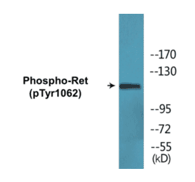 Western Blot - Ret (phospho Tyr1062) Cell Based ELISA Kit (CBP1670) - Antibodies.com