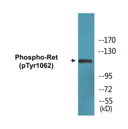 Western Blot - Ret (phospho Tyr1062) Cell Based ELISA Kit (CBP1670) - Antibodies.com