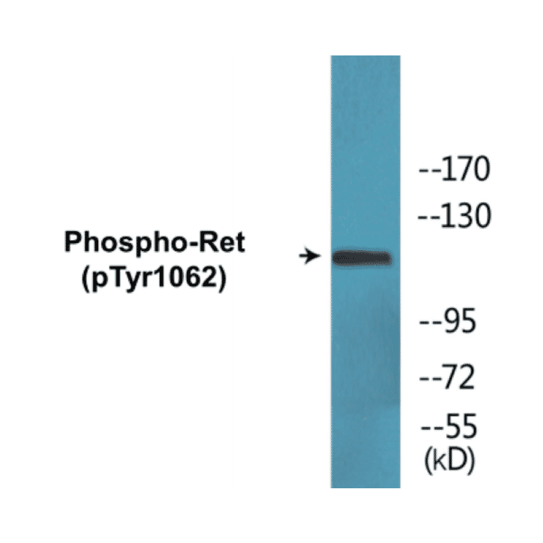 Western Blot - Ret (phospho Tyr1062) Cell Based ELISA Kit (CBP1670) - Antibodies.com