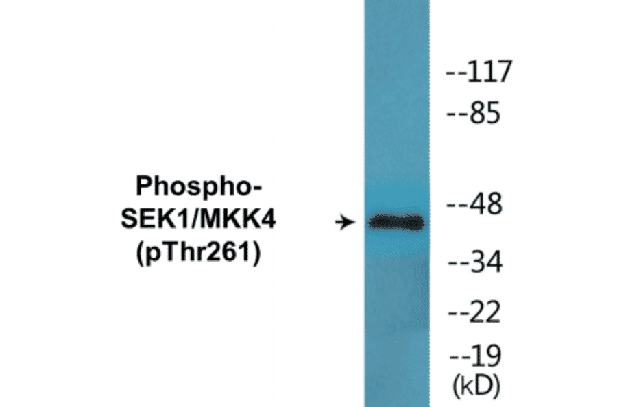Western Blot - SEK1 (phospho Thr261) Cell Based ELISA Kit (CBP1673) - Antibodies.com