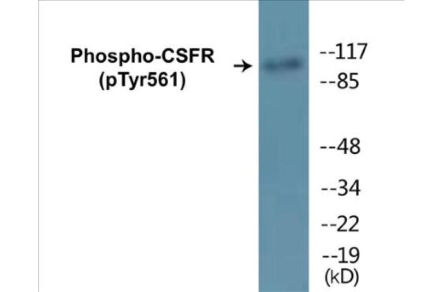Western Blot - CSFR (phospho Tyr561) Cell Based ELISA Kit (CBP1351) - Antibodies.com