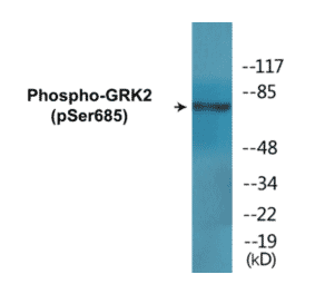 Western Blot - GRK2 (phospho Ser685) Cell Based ELISA Kit (CBP1803) - Antibodies.com