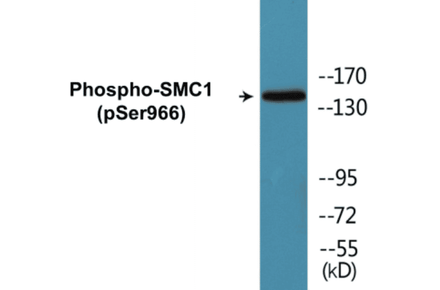 Western Blot - SMC1 (phospho Ser966) Cell Based ELISA Kit (CBP1215) - Antibodies.com