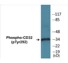 Western Blot - CD32 (phospho Tyr292) Cell Based ELISA Kit (CBP1246) - Antibodies.com