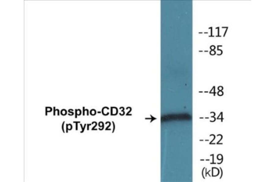 Western Blot - CD32 (phospho Tyr292) Cell Based ELISA Kit (CBP1246) - Antibodies.com