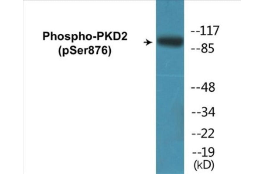 Western Blot - PKD2 (phospho Ser876) Cell Based ELISA Kit (CBP1313) - Antibodies.com