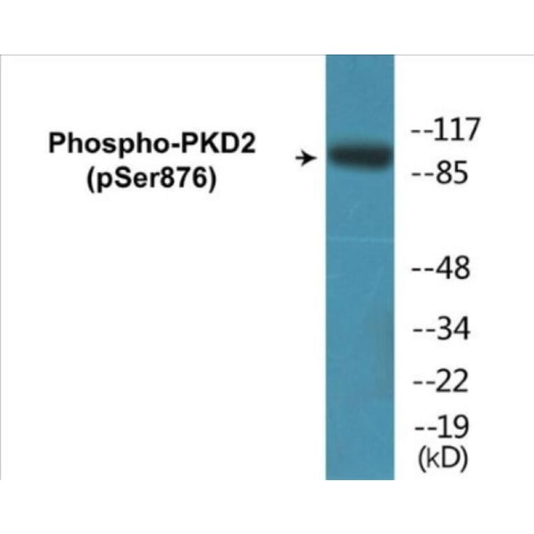Western Blot - PKD2 (phospho Ser876) Cell Based ELISA Kit (CBP1313) - Antibodies.com