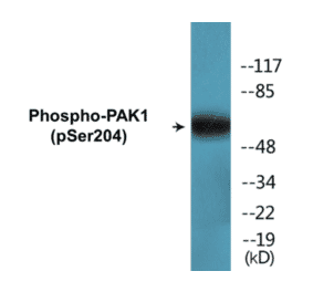 Western Blot - PAK1 (phospho Ser204) Cell Based ELISA Kit (CBP1761) - Antibodies.com