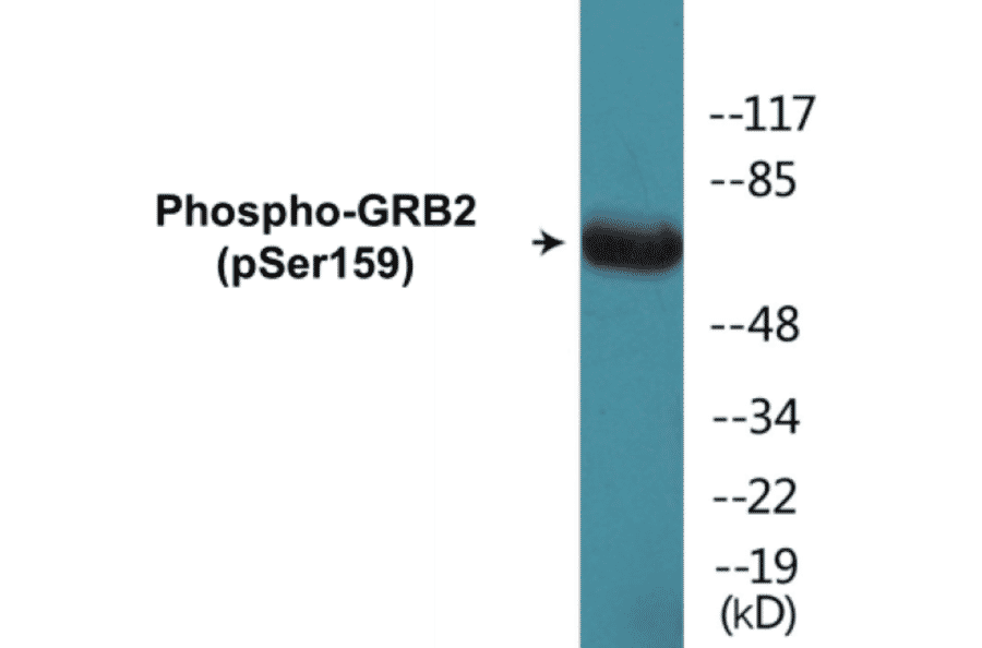 Western Blot - GRB2 (phospho Ser159) Cell Based ELISA Kit (CBP1796) - Antibodies.com