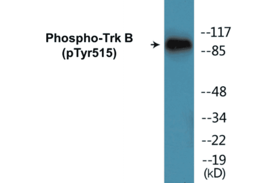 Western Blot - TrkB (phospho Tyr515) Cell Based ELISA Kit (CBP1033) - Antibodies.com