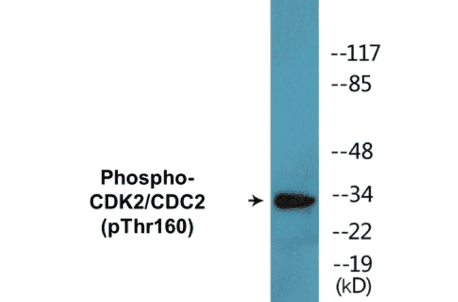 Western Blot - CDK2 (phospho Thr160) Cell Based ELISA Kit (CBP1043) - Antibodies.com
