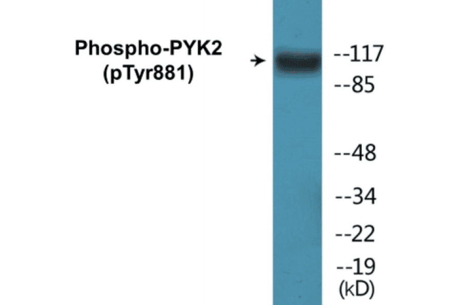 Western Blot - PYK2 (phospho Tyr881) Cell Based ELISA Kit (CBP1076) - Antibodies.com