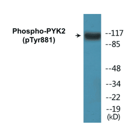 Western Blot - PYK2 (phospho Tyr881) Cell Based ELISA Kit (CBP1076) - Antibodies.com