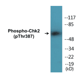 Western Blot - Chk2 (phospho Thr387) Cell Based ELISA Kit (CBP1106) - Antibodies.com
