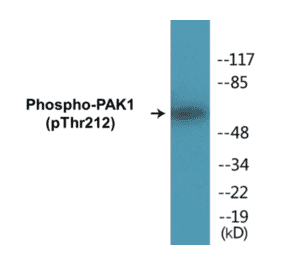 Western Blot - PAK1 (phospho Thr212) Cell Based ELISA Kit (CBP1196) - Antibodies.com