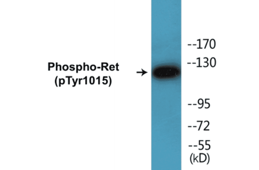 Western Blot - Ret (phospho Tyr1015) Cell Based ELISA Kit (CBP1212) - Antibodies.com