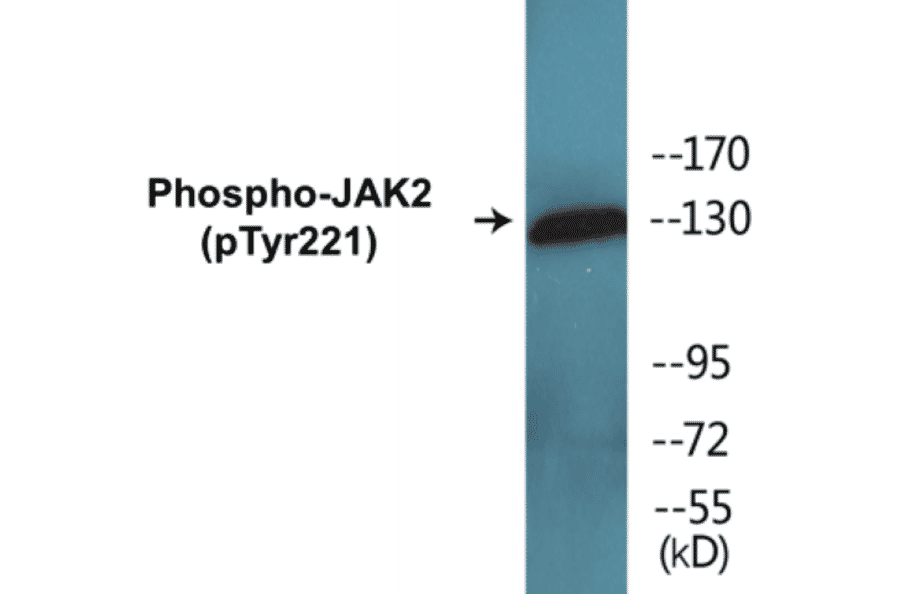 Western Blot - JAK2 (phospho Tyr221) Cell Based ELISA Kit (CBP1593) - Antibodies.com