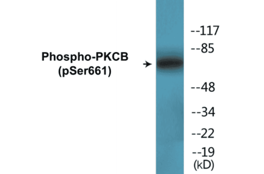 Western Blot - PKCB (phospho Ser661) Cell Based ELISA Kit (CBP1766) - Antibodies.com