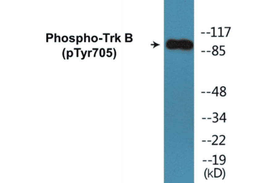 Western Blot - TrkB (phospho Tyr705) Cell Based ELISA Kit (CBP1034) - Antibodies.com