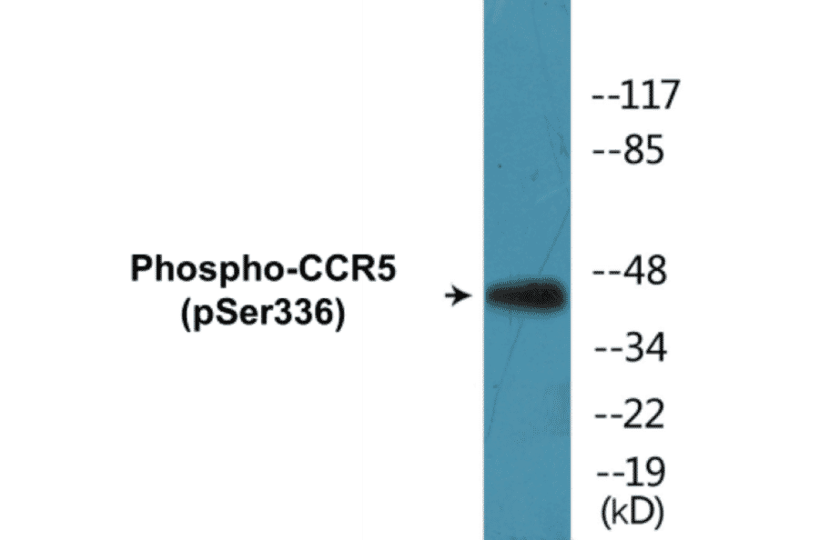 Western Blot - CCR5 (phospho Ser336) Cell Based ELISA Kit (CBP1054) - Antibodies.com