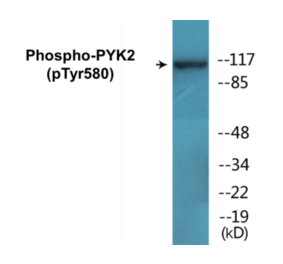 Western Blot - PYK2 (phospho Tyr580) Cell Based ELISA Kit (CBP1077) - Antibodies.com