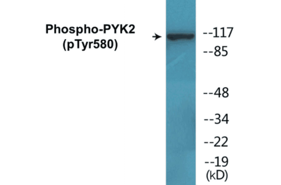 Western Blot - PYK2 (phospho Tyr580) Cell Based ELISA Kit (CBP1077) - Antibodies.com