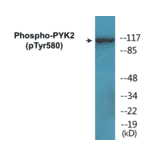 Western Blot - PYK2 (phospho Tyr580) Cell Based ELISA Kit (CBP1077) - Antibodies.com