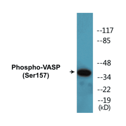Western Blot - VASP (phospho Ser157) Cell Based ELISA Kit (CBP1088) - Antibodies.com