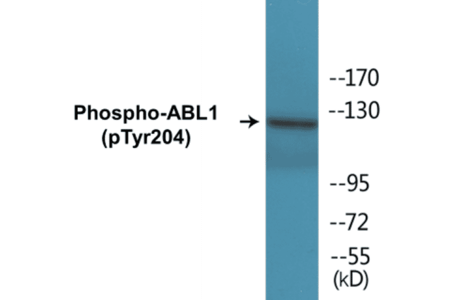 Western Blot - ABL1 (phospho Tyr204) Cell Based ELISA Kit (CBP1096) - Antibodies.com