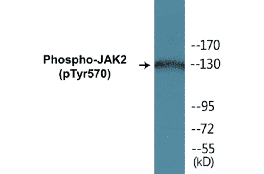 Western Blot - JAK2 (phospho Tyr570) Cell Based ELISA Kit (CBP1168) - Antibodies.com