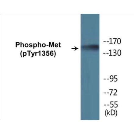 Western Blot - Met (phospho Tyr1356) Cell Based ELISA Kit (CBP1178) - Antibodies.com