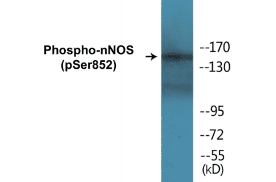 Western Blot - nNOS (phospho Ser852) Cell Based ELISA Kit (CBP1186) - Antibodies.com