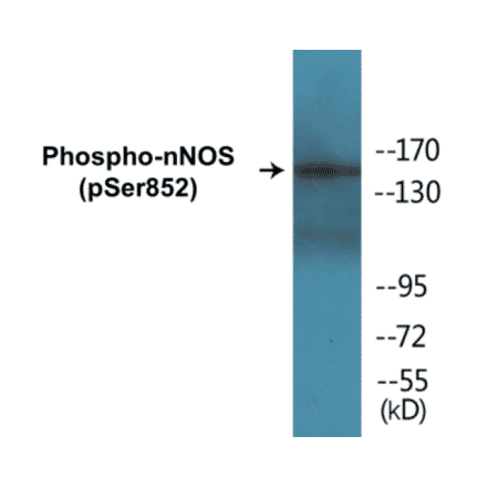 Western Blot - nNOS (phospho Ser852) Cell Based ELISA Kit (CBP1186) - Antibodies.com