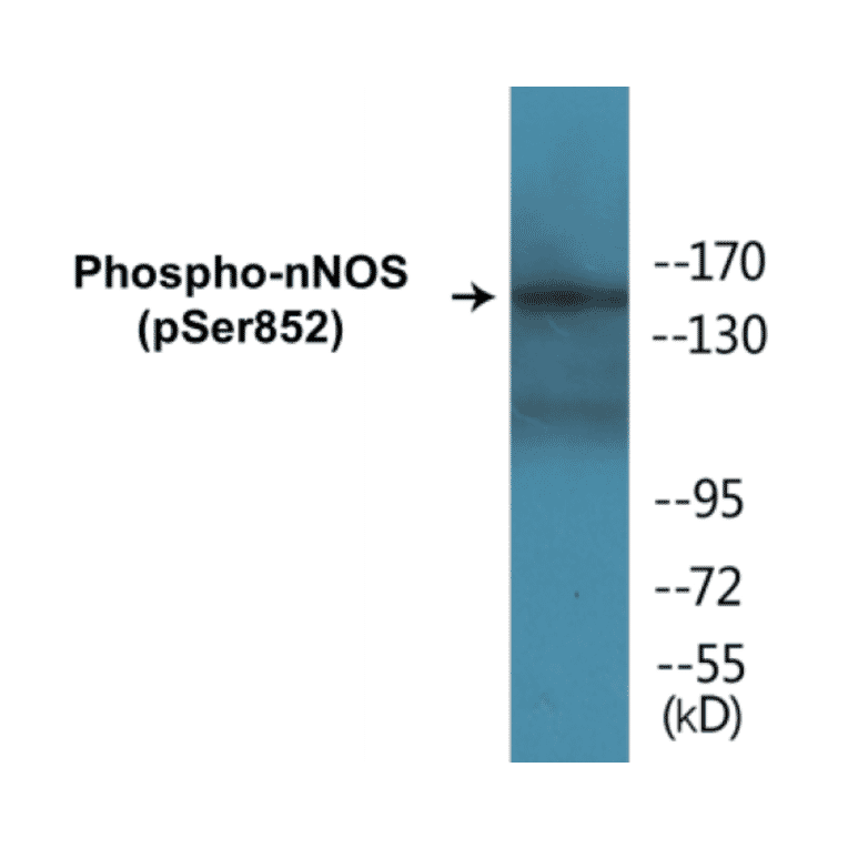 Western Blot - nNOS (phospho Ser852) Cell Based ELISA Kit (CBP1186) - Antibodies.com