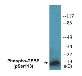 Western Blot - TEBP (phospho Ser113) Cell Based ELISA Kit (CBP1222) - Antibodies.com